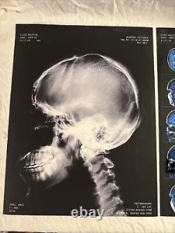 2 Screen Used NOS4A2 Movie Prop Victoria VIC McQUEEN X-rays Charlie Manx
