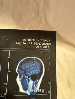 2 Screen Used NOS4A2 Movie Prop Victoria VIC McQUEEN X-rays Charlie Manx