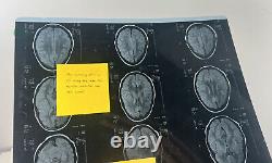 Roswell, New Mexico The CW Screen Used Dallas Alien Brain Scan with Post-it Notes