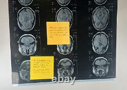 Roswell, New Mexico The CW Screen Used Dallas Alien Brain Scan with Post-it Notes